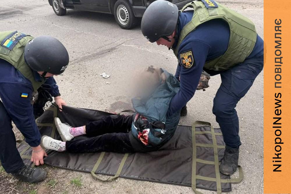 У Нікополі важко поранено 16-річну доньку журналіста – потрібна допомога