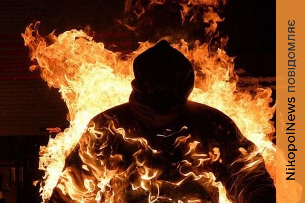 «Самотужки знімав одяг зі шматочками обгорілої шкіри»: на Нікопольщині чоловік розпалив багаття на подвір’ї, але вогонь перекинувся на нього 1 На Нікопольщині