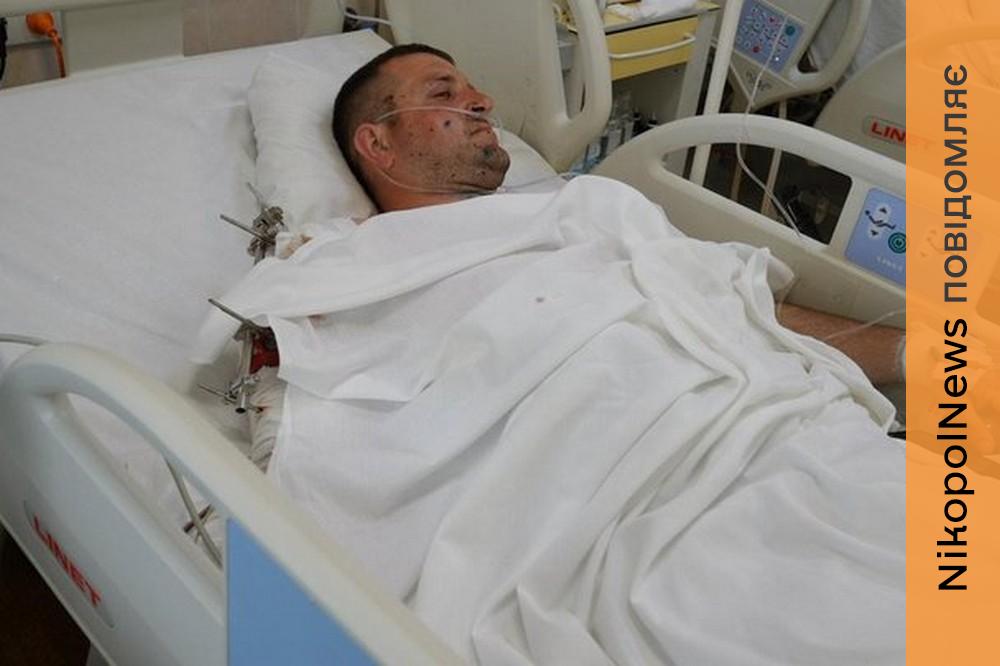 «Я з мотоцикла зістрибую, і він прям у нього влітає...»: як житель Нікопольщини проходить лікування після удару ворожого дрона (відео) 1 Нікопольщини