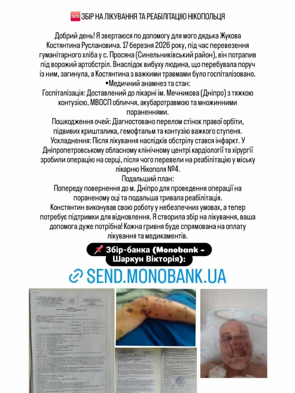 Потрапив під обстріл, коли розвозив гуманітарний хліб: мешканцю Нікополя потрібна допомога