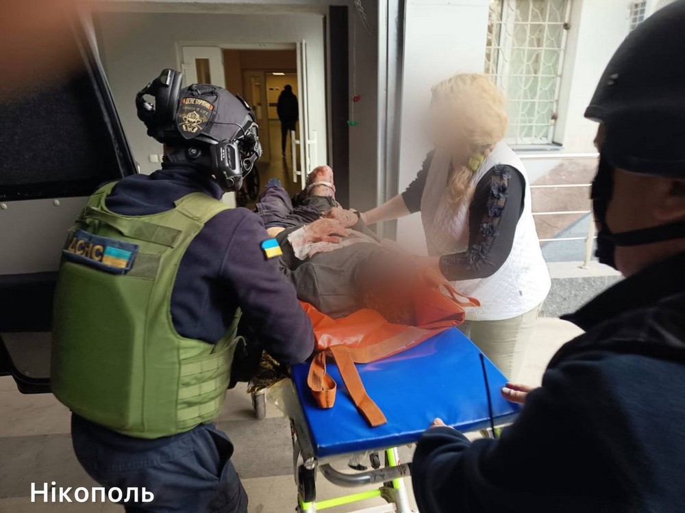 Троє поранених у Нікополі вранці 1 квітня – одна людина вкрай «важка» Троє поранених у Нікополі вранці 1 квітня – одна людина вкрай «важка»