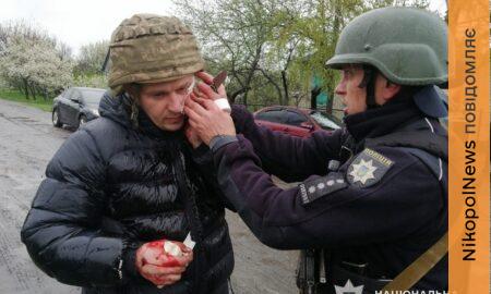 П’ятеро поліцейських поранено на Дніпропетровщині внаслідок вибуху гранати – що відомо
