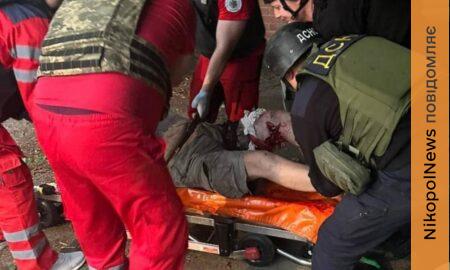Нікополь накрили «Градом»: є важко поранений, побито музей, садочок, комунальне підприємство, також під обстрілами були район, Апостолове, Самар, Кам’янське і Синельниківщина (фото)