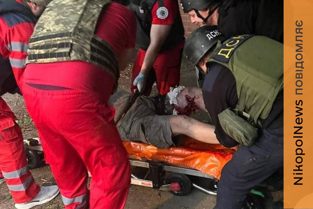 Нікополь накрили «Градом»: є важко поранений, побито музей, садочок, комунальне підприємство, також під обстрілами були район, Апостолове, Самар, Кам’янське і Синельниківщина (фото)