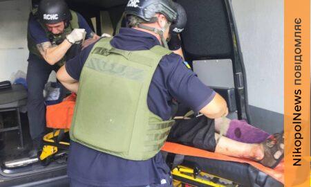 На Нікопольщині є поранений, вранці ворог вдарив по Нікополю, побито АЗС, мікроавтобус, підприємства і будинки, також під обстрілами була Синельниківщина (фото)