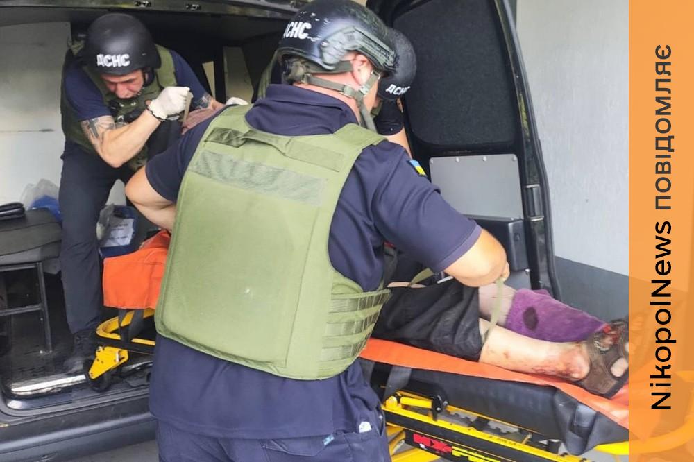 На Нікопольщині є поранений, вранці ворог вдарив по Нікополю, побито АЗС, мікроавтобус, підприємства і будинки, також під обстрілами була Синельниківщина (фото)