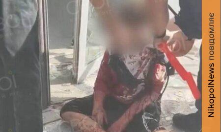 Повз по склу і молився: 10-річний хлопчик вижив після удару по ТЦ у Кривому Розі, але втратив рідних (фото)