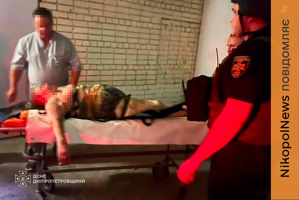 Один загиблий та 11 постраждалих, серед них діти: про наслідки обстрілів Нікопольщини розповіли у ДСНС (фото)