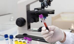 На Нікопольщині виявили холероподібний вібріон, також в області зафіксували отруєння грибами: яка епідемічна ситуація на Дніпропетровщині