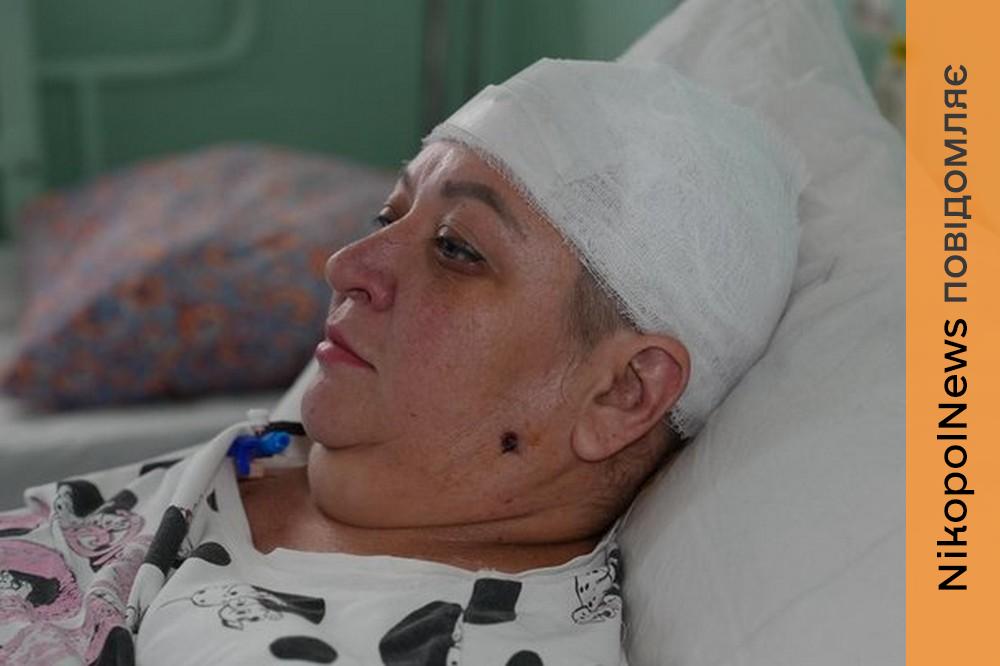 «Знімала білизну під вікном, аж тут дрон вдарив по голові» - поранена у Нікополі жінка розповіла про страшний день у своєму житті