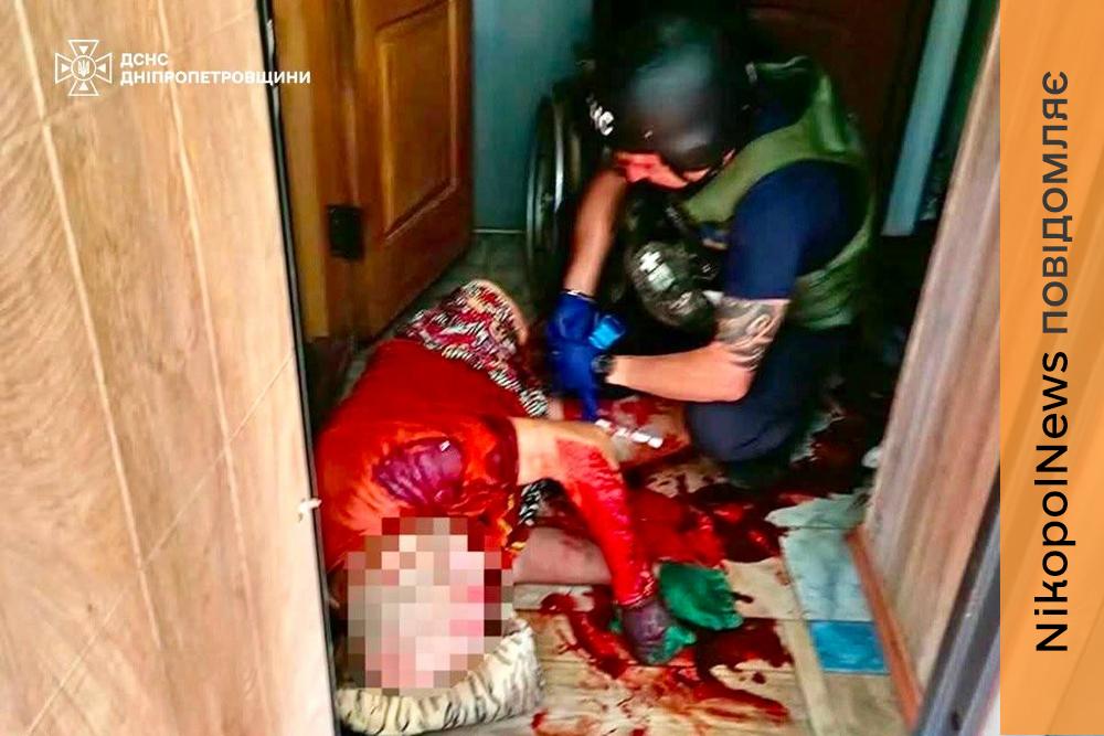 Один загиблий та 6 поранених: про наслідки обстрілів Нікополького, Дніпровського, Павлоградського та Синельниківського районів розповіли у ДСНС (фото)
