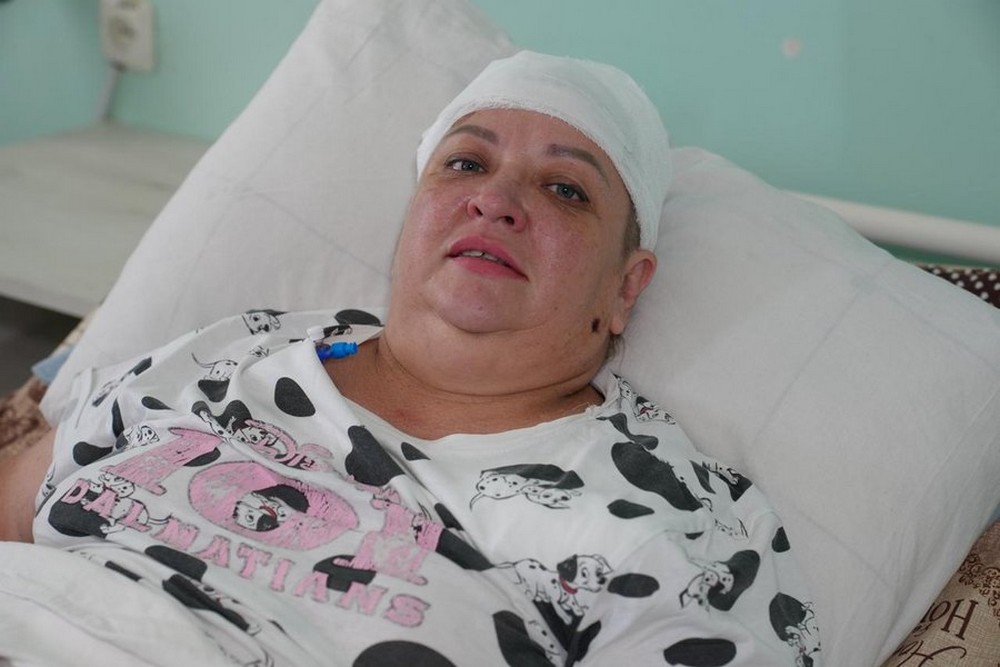«Знімала білизну під вікном, аж тут дрон вдарив по голові» - поранена у Нікополі жінка розповіла про страшний день у своєму житті