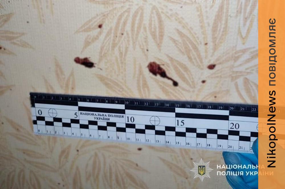 Зайшов до кімнати, де спала на дивані його 88-річна тітка, і побив її до смерті: моторошне вбивство на Нікопольщині