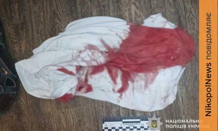 Різанина в квартирі у Нікополі: правоохоронці затримали нападника