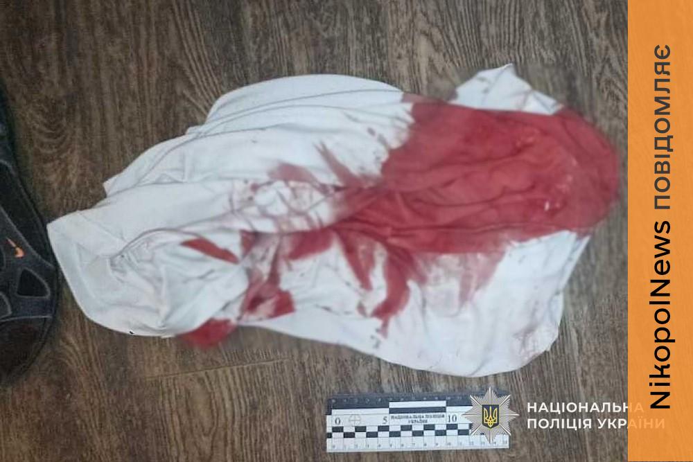 Різанина в квартирі у Нікополі: правоохоронці затримали нападника