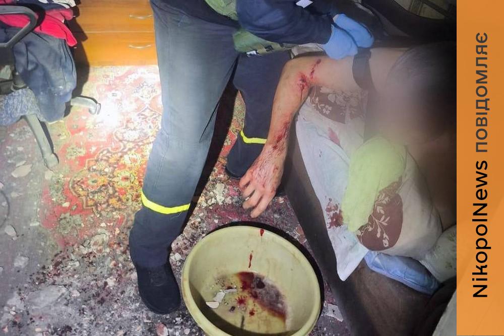 У Нікополі є поранений, троє вбитих і 14 поранених на Синельниківщині, у Дніпрі атаковано критичну інфраструктуру (відео)