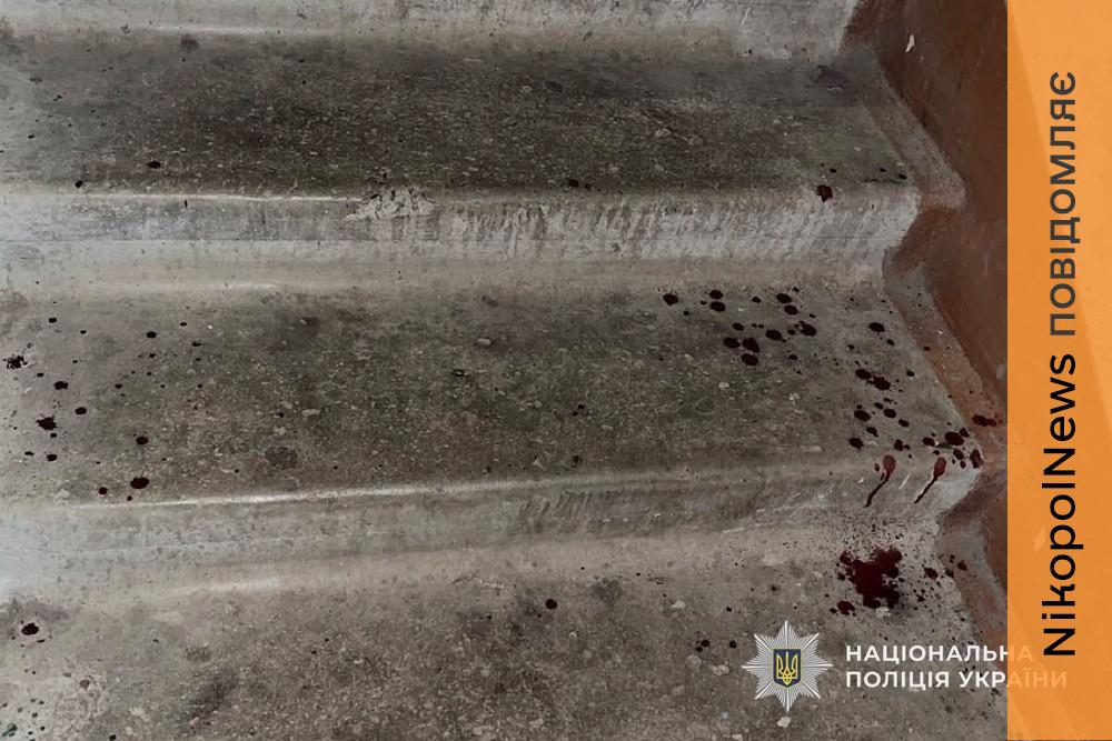 Нападав на жінок у під’їздах: затримано вбивцю у Кривому Розі