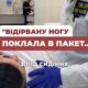 Поклала відірвану ногу у пакет
