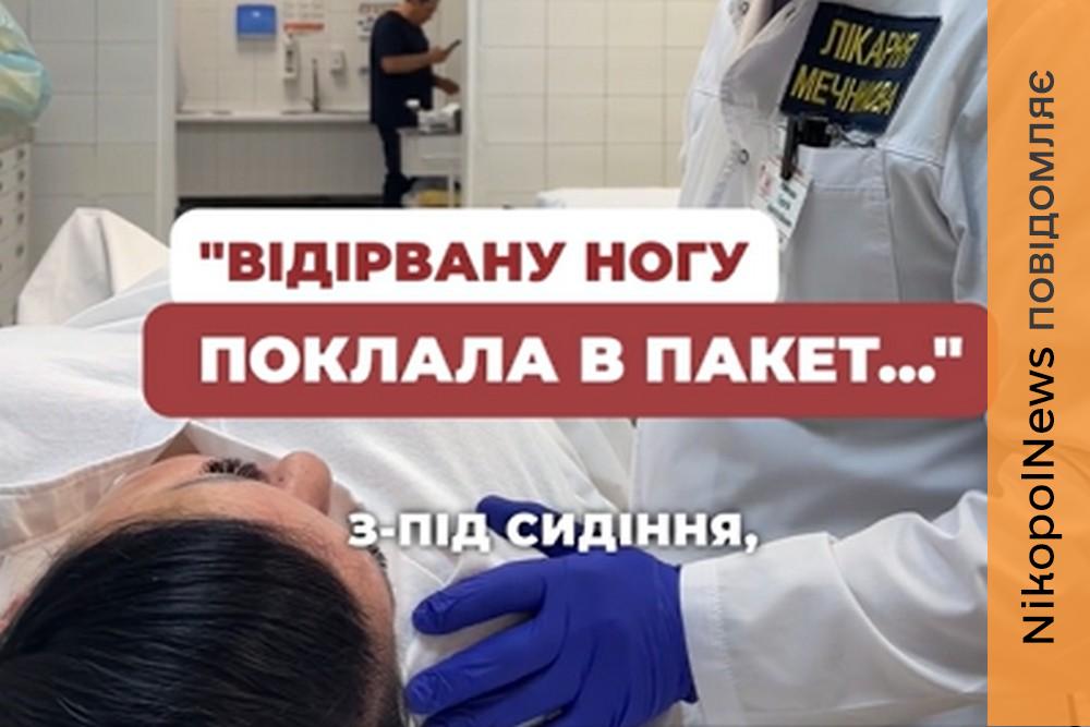 Поклала відірвану ногу у пакет і пострибала до авто: у Дніпрі рятують зооволонтерку, яку атакував ворожий дрон (відео)